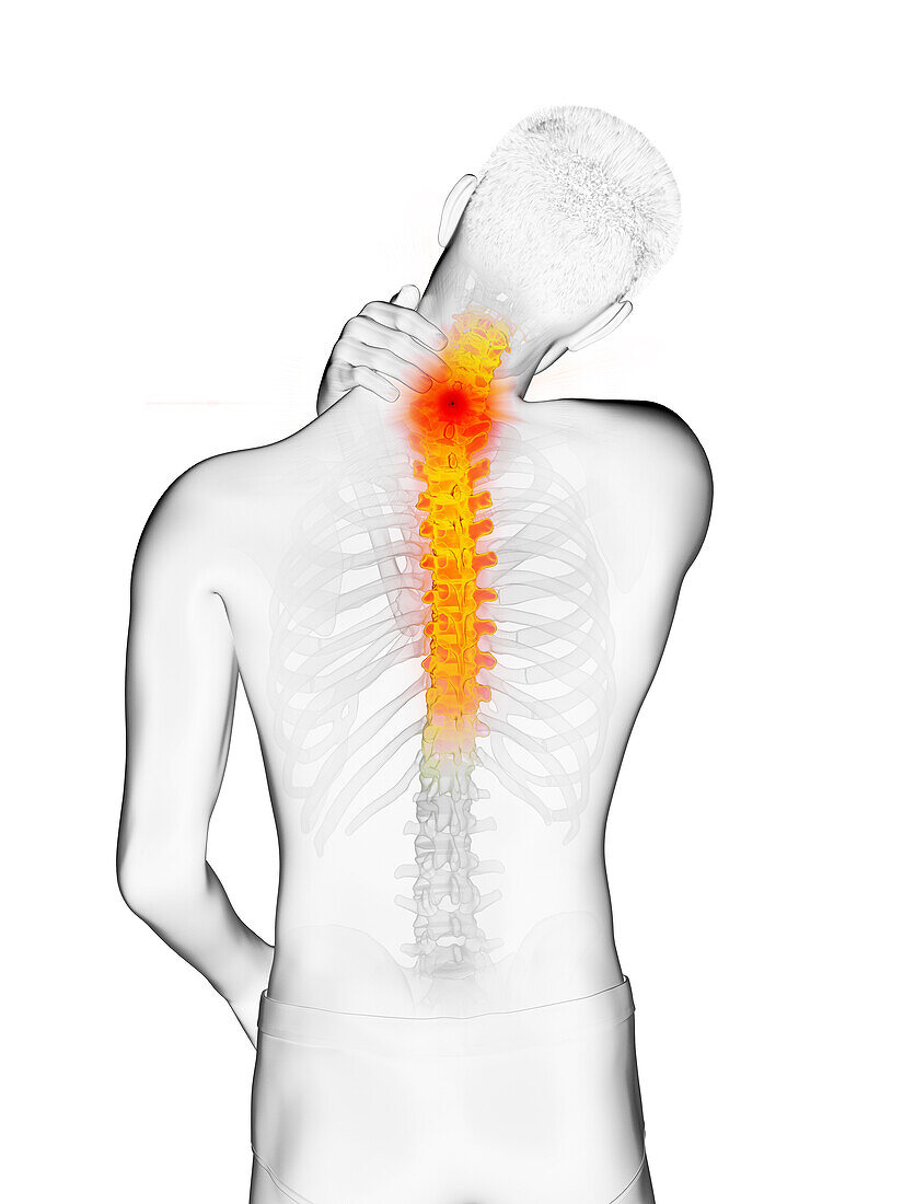 Man with a painful upper back, illustration