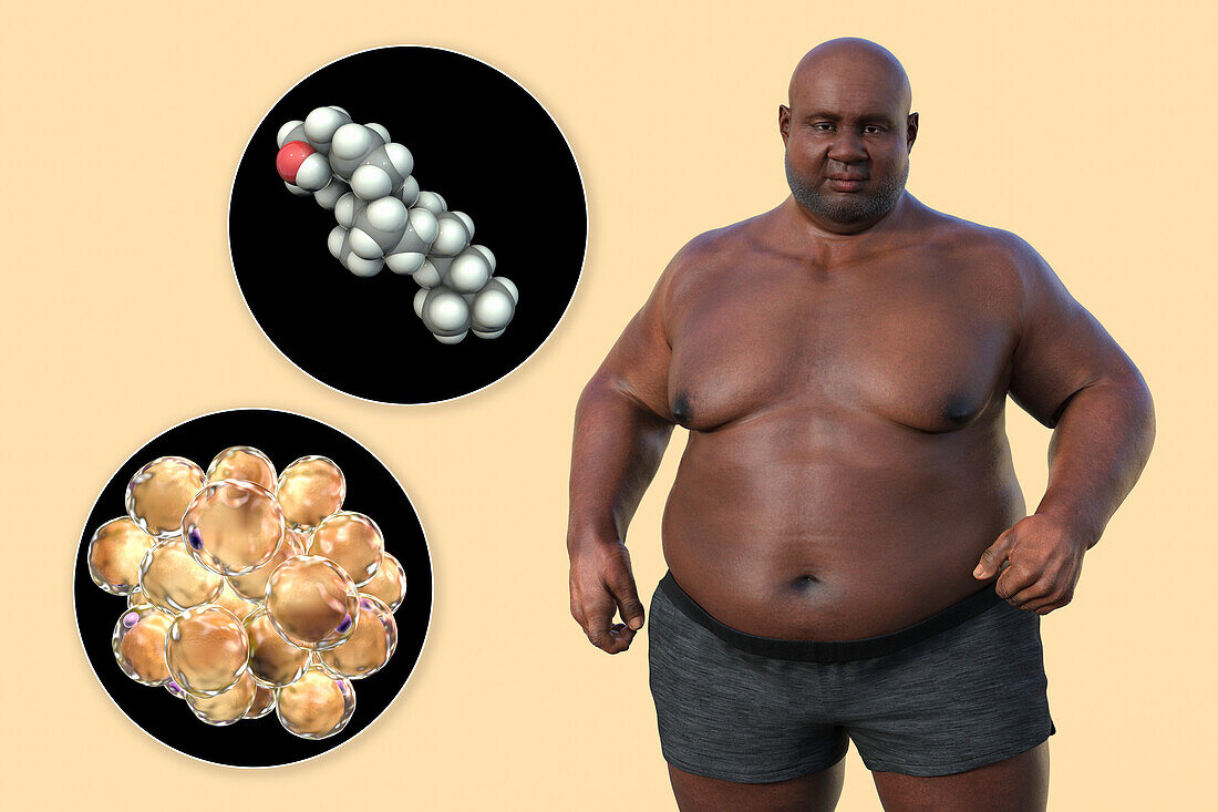 Overweight man with adipocytes, illustration