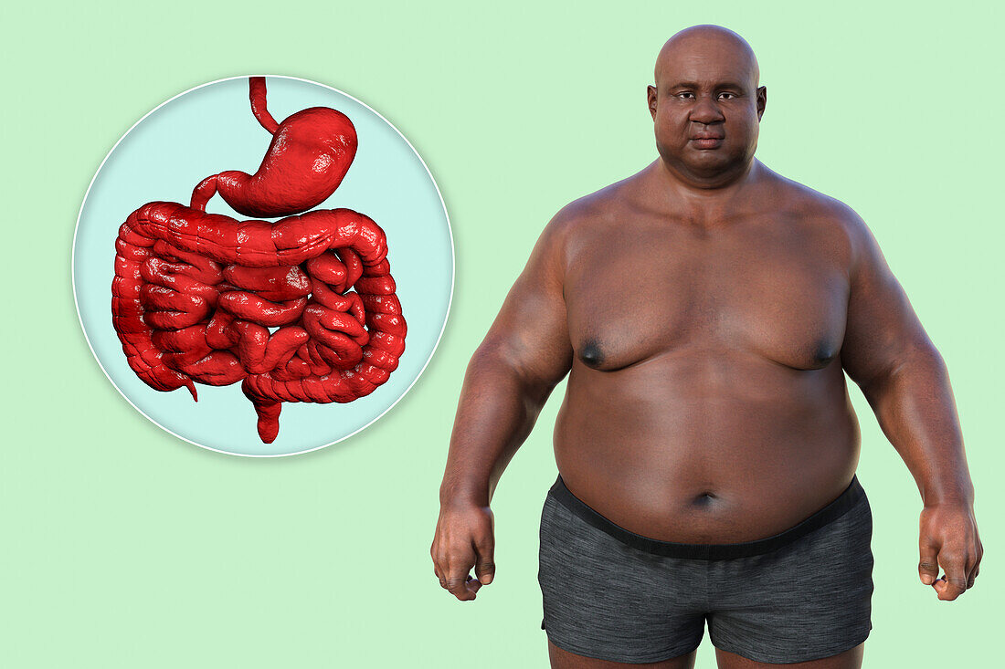 Obese man's digestive system, illustration