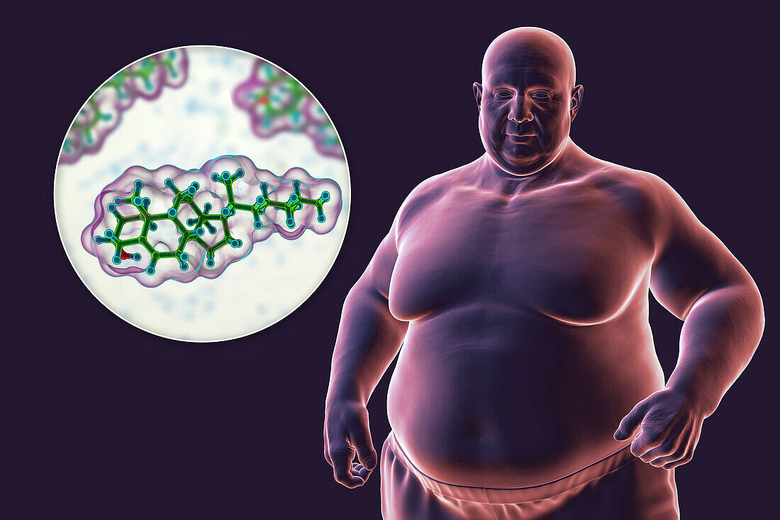 Overweight man and cholesterol molecule, illustration