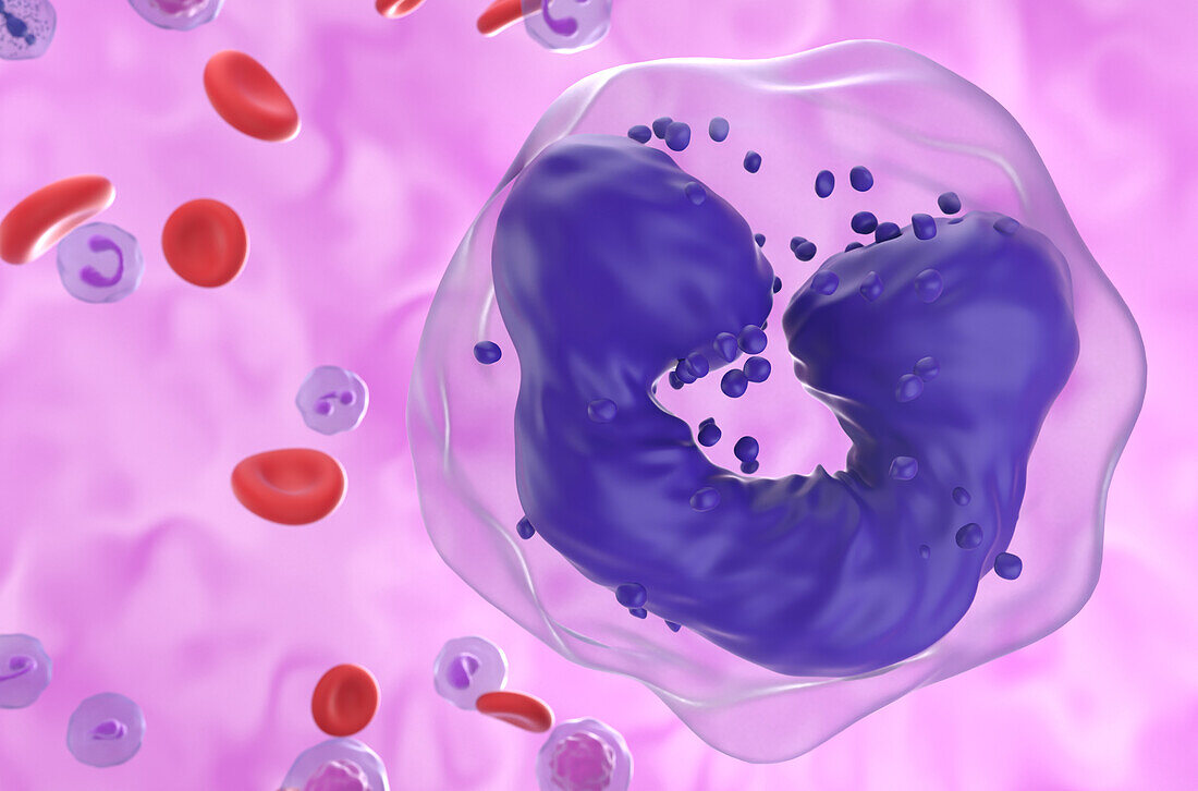 Chronic myeloid leukaemia, illustration