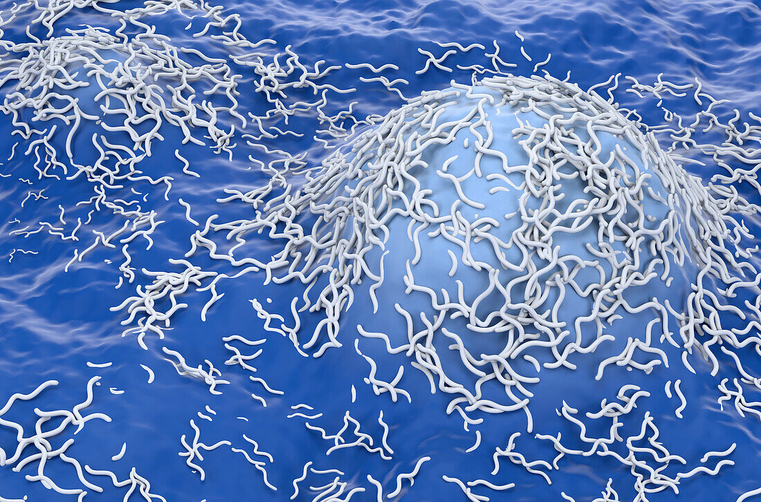 Ependymoma cancer cells, illustration