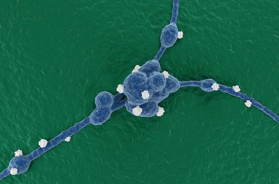 Neuroblastoma cancer cells, illustration