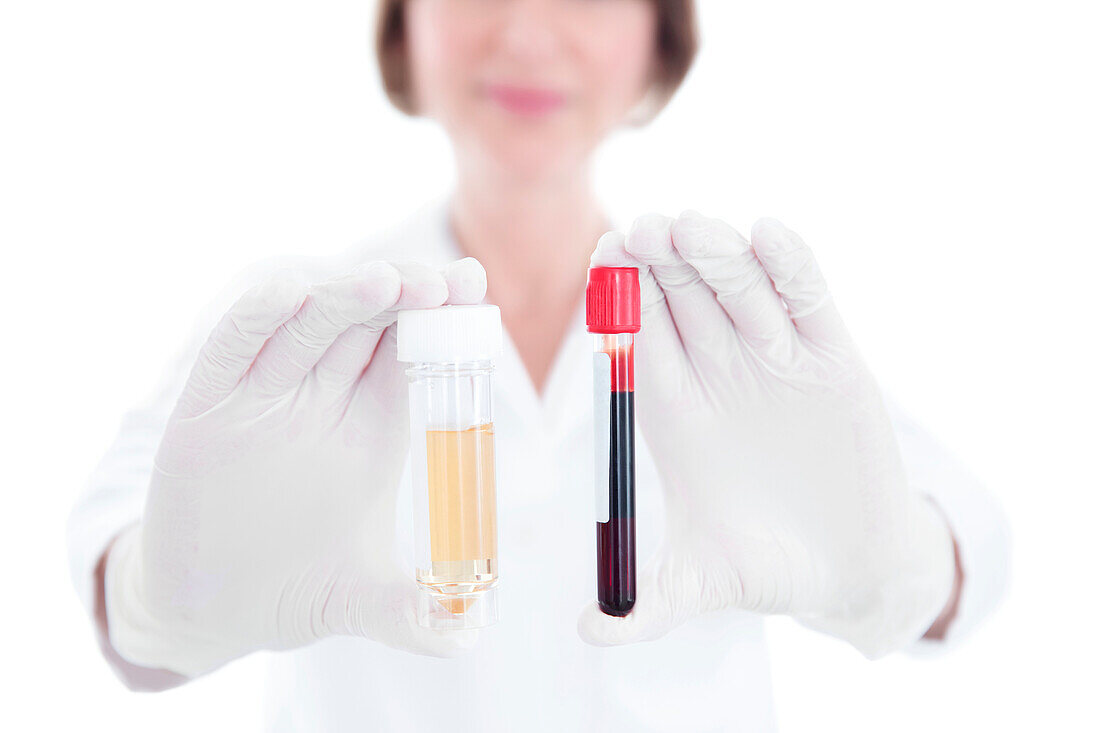 Doctor with urine and blood samples
