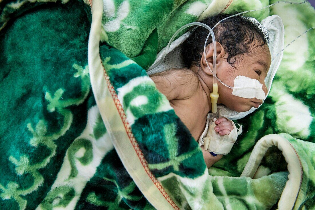 Papua-Neuguinea,Provinz Westliches Hochland,Mount Hagen,Mount Hagen Hospital,untergewichtiges Baby wird in einer Isolierstation warm gehalten