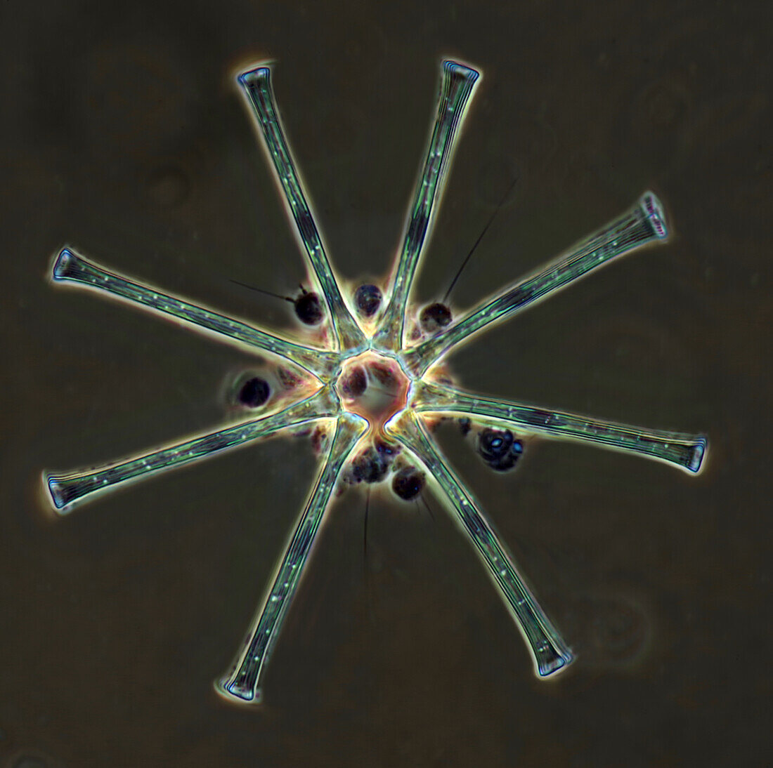 Diatom and choanoflagellates, light micrograph