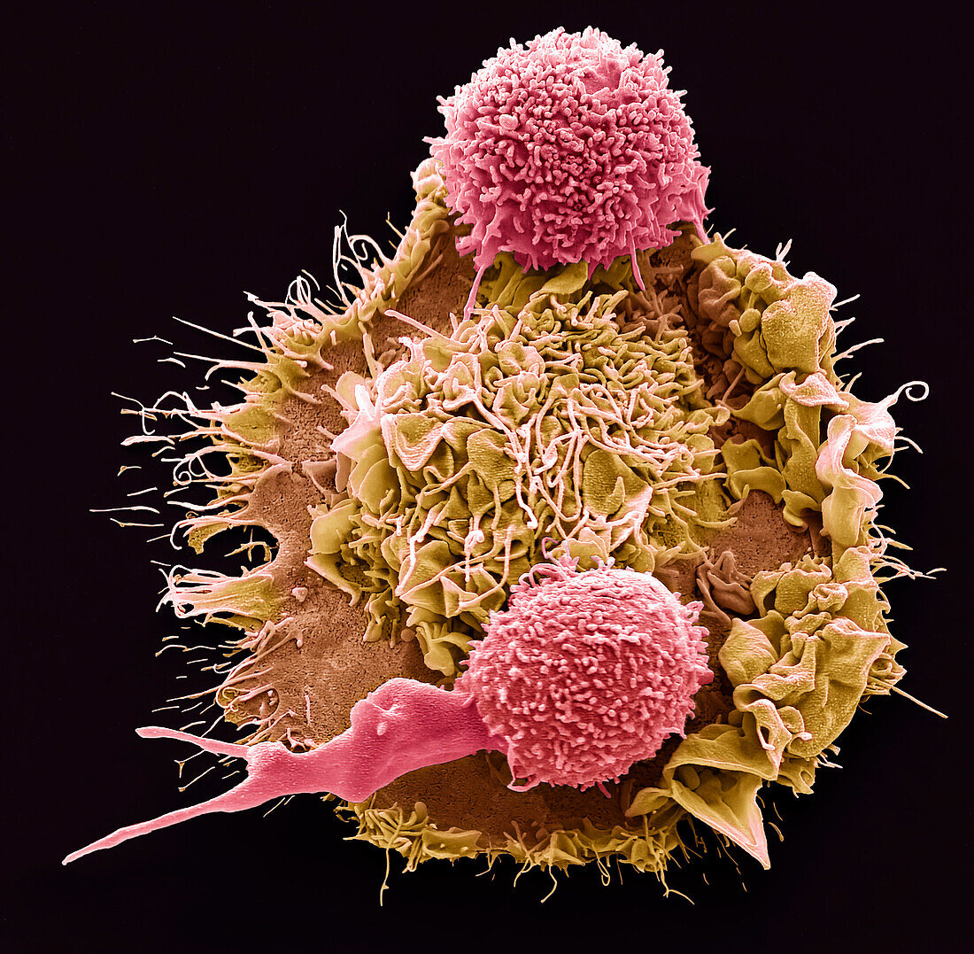 Macrophage and T cells, SEM