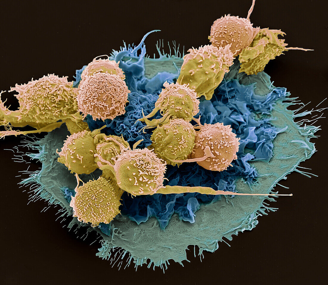 Macrophage and T cells, SEM