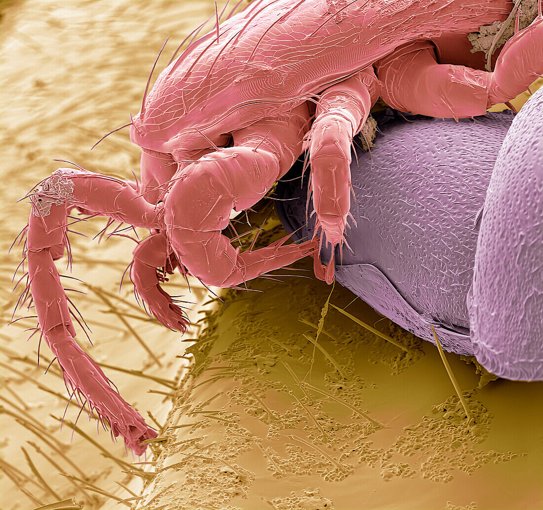 Bumblebee mite and eggs, SEM.