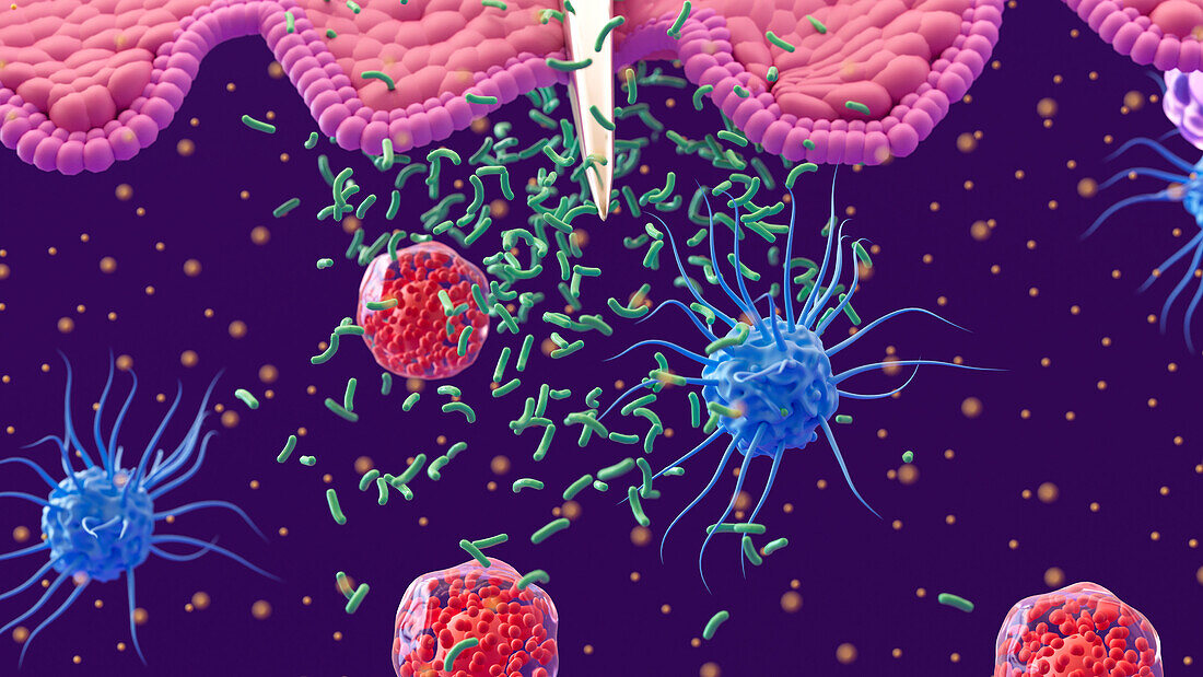 White blood cells responding to bacterial infection, illustration