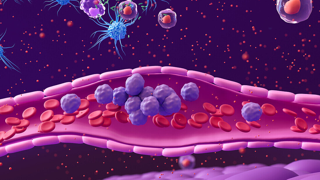 White blood cells moving to site of infection, illustration