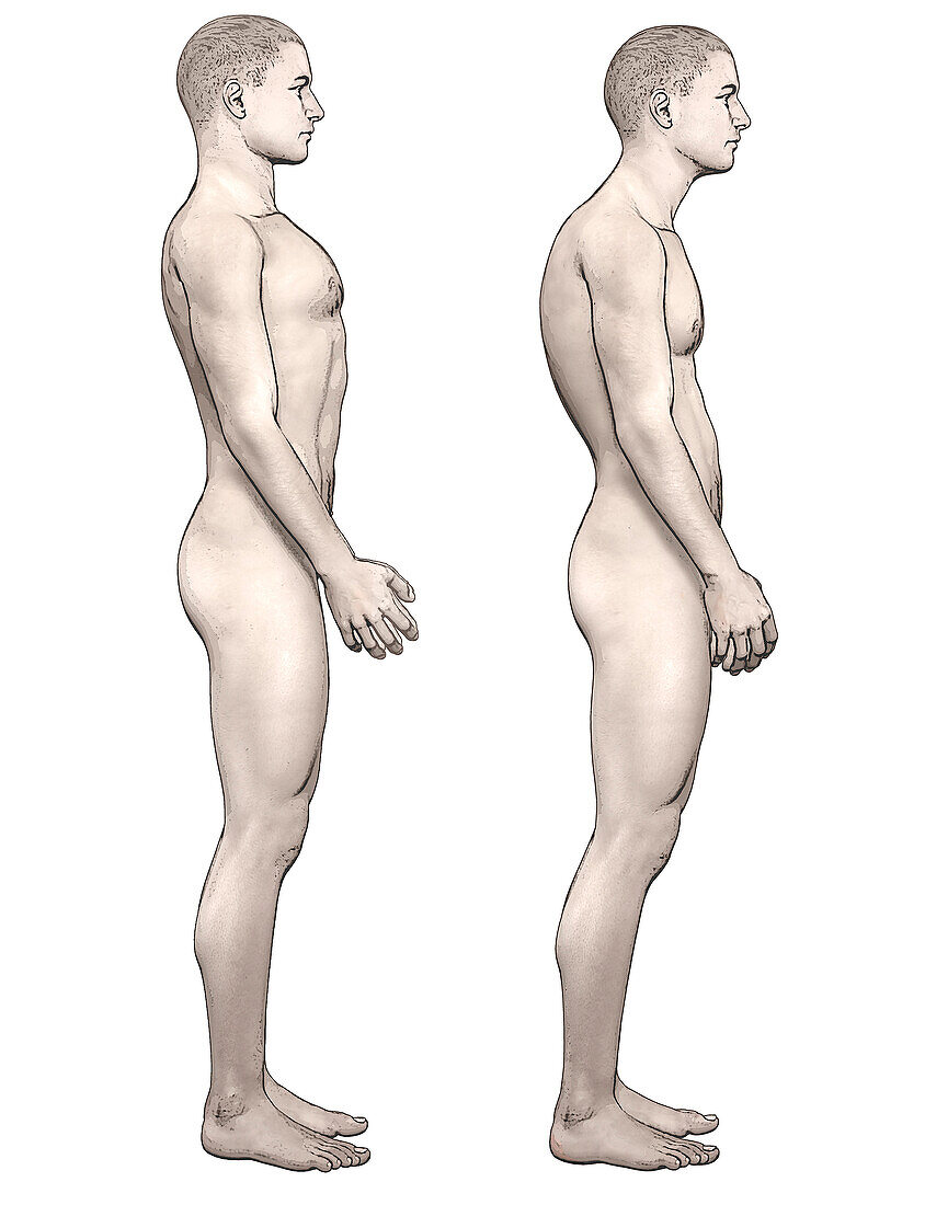 Good and bad body posture, illustration