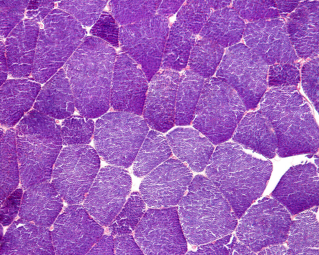 Muscle fibres, light micrograph