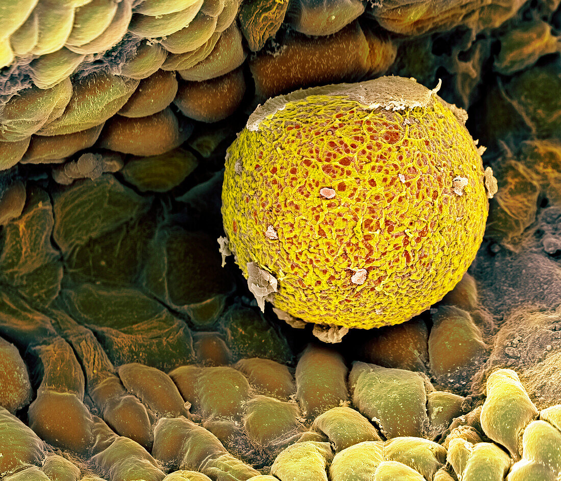 Human ovum in fallopian tube, SEM