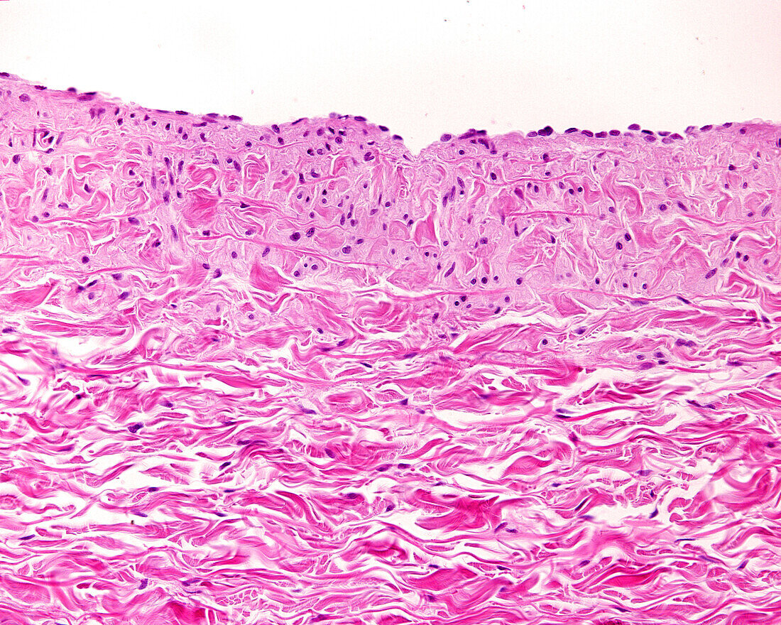 Vein wall, light micrograph