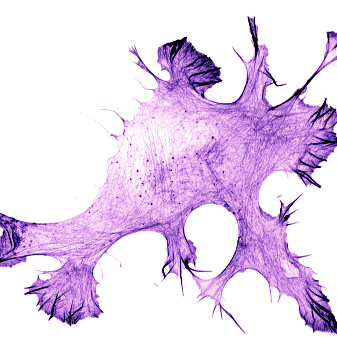 Migrating Ewing sarcoma cancer cell, confocal light micrograph