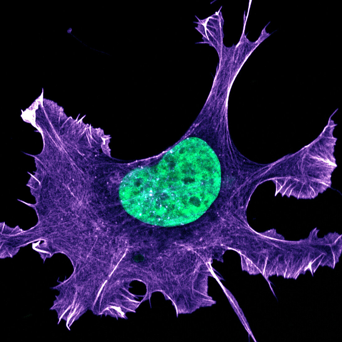 Migrating Ewing sarcoma cancer cell, confocal light micrograph