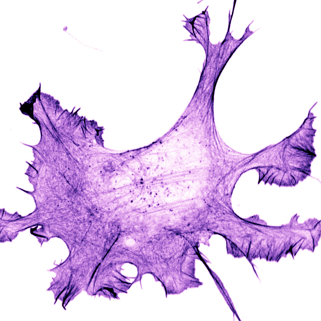 Migrating Ewing sarcoma cancer cell, confocal light micrograph