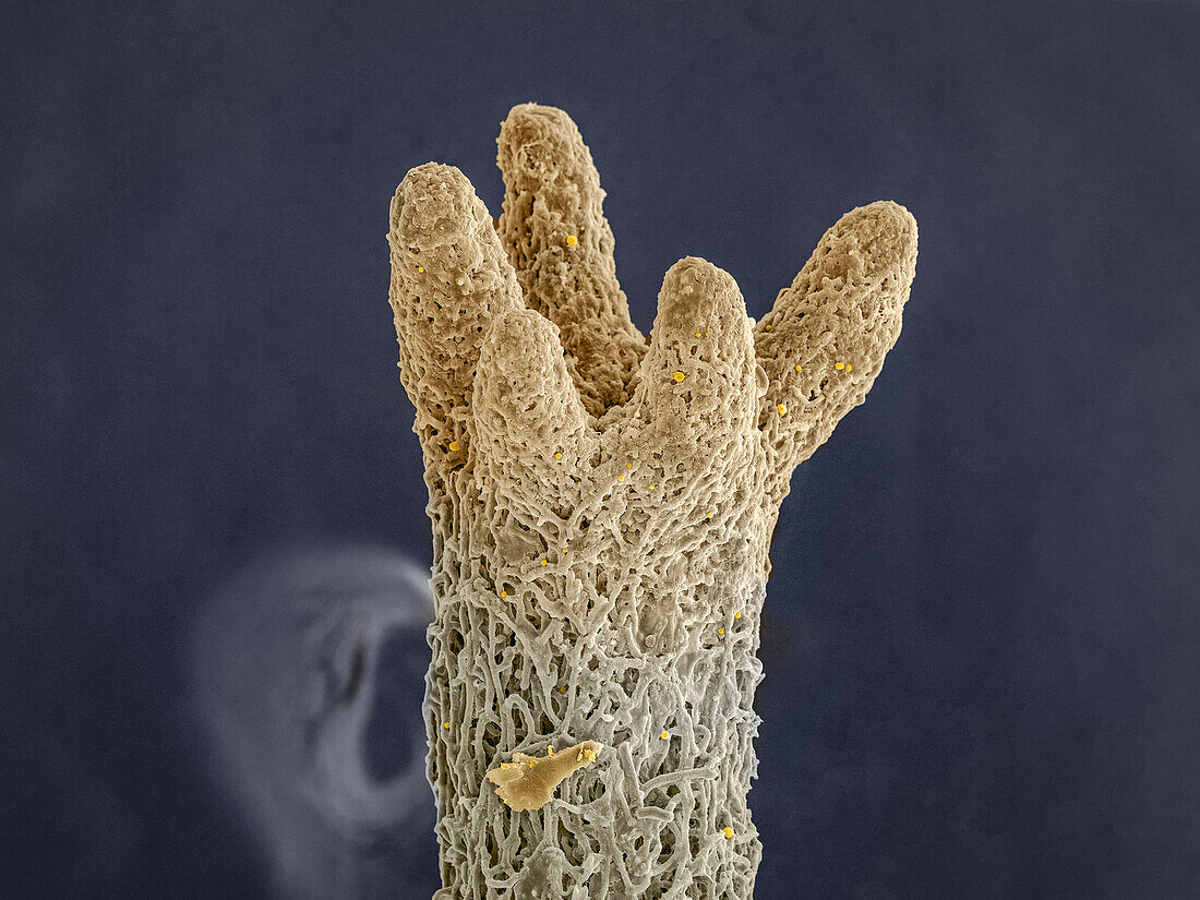 Reindeer lichen, SEM