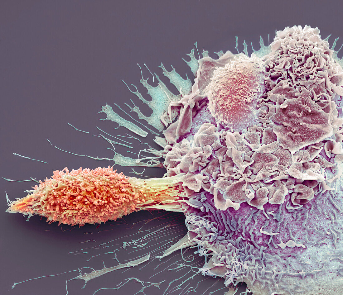 Macrophage and a T cell, SEM