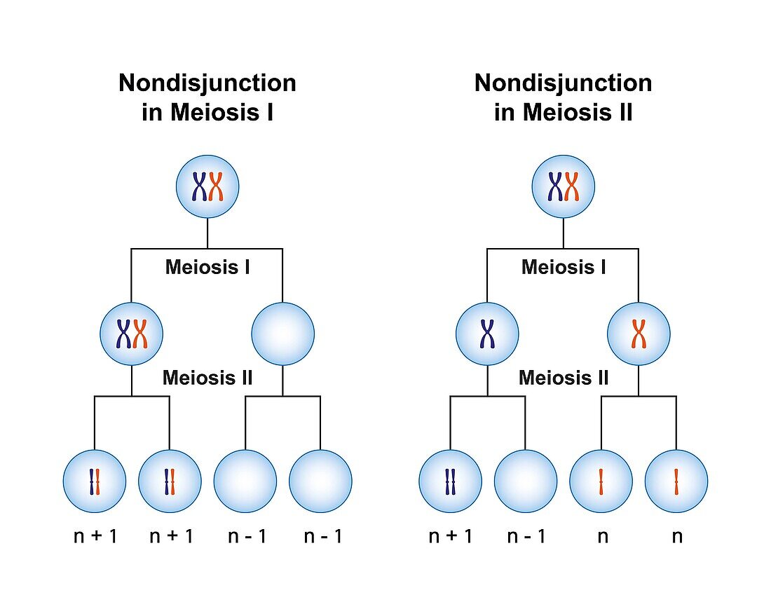 Nondisjunction in meiosis, illustration