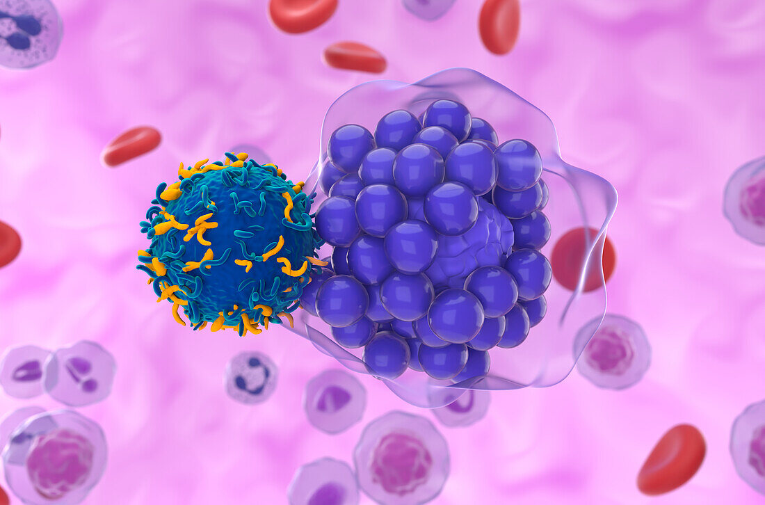 CAR-T cell therapy for diffuse large B-cell lymphoma, illustration