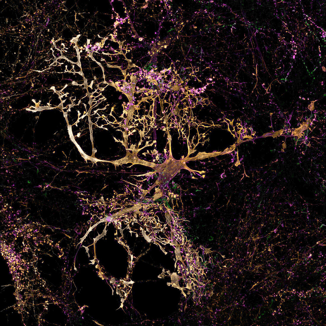 Astrocyte cells, light micrograph