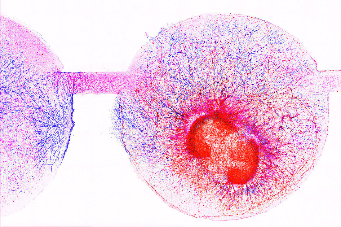 Brain organoids, light micrograph