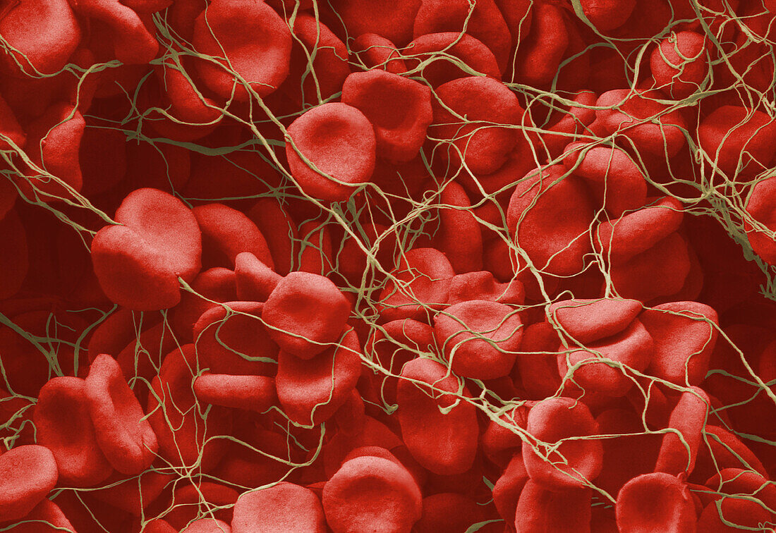 Red blood cells forming clot, SEM