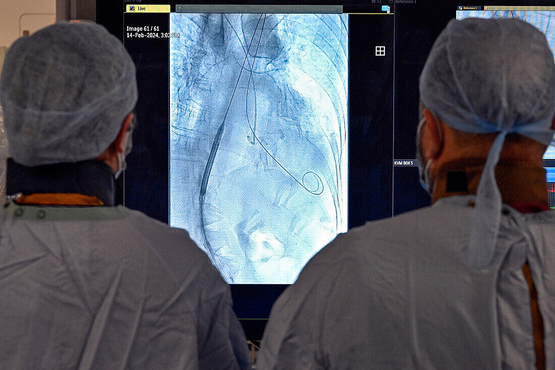 Doctors observing live X-ray during TAVI procedure