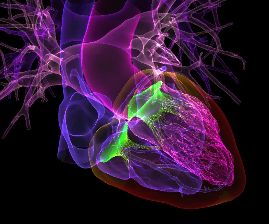 Human heart, CT scan