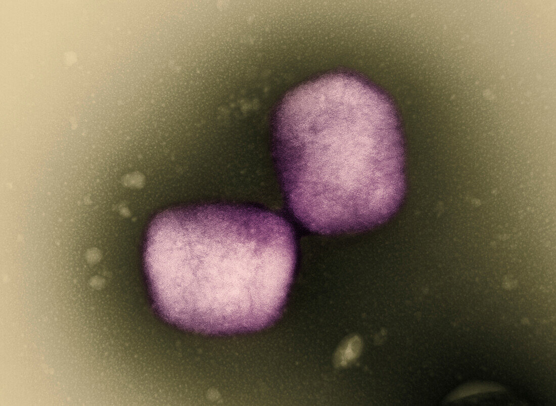 Mpox virus particles, TEM