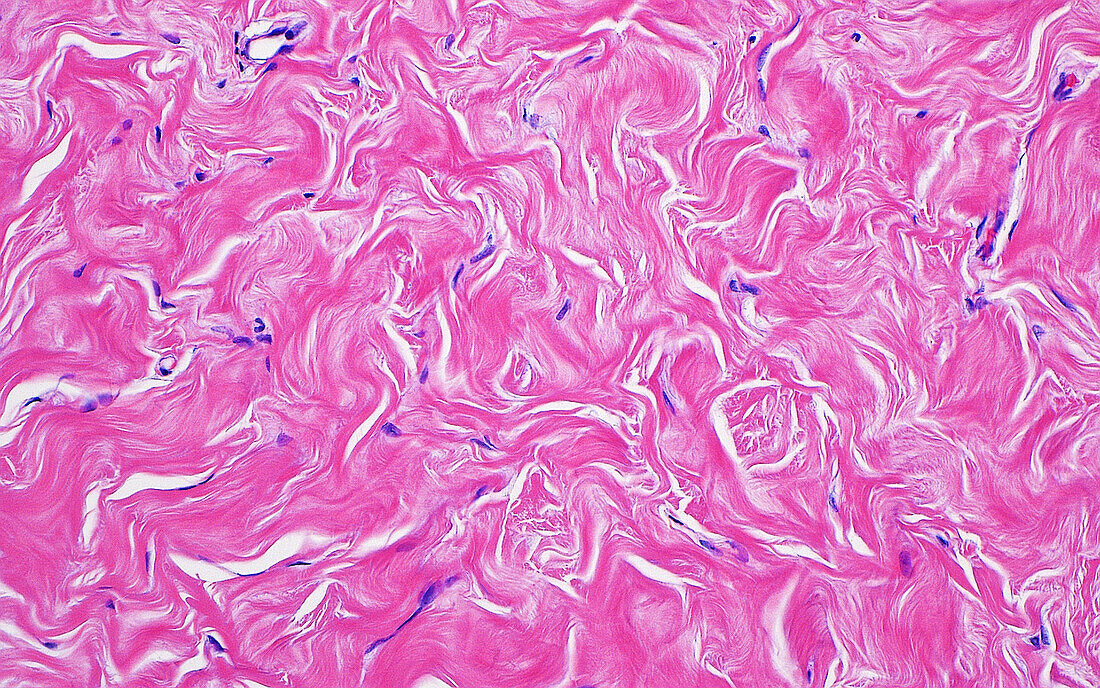 Breast collagen fibres, light micrograph