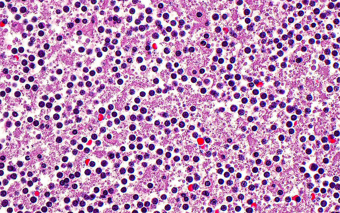 Lymphocytes and other blood cells, light micrograph