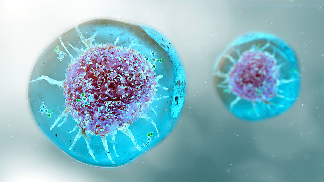 Hydrogel cancer therapy, conceptual illustration