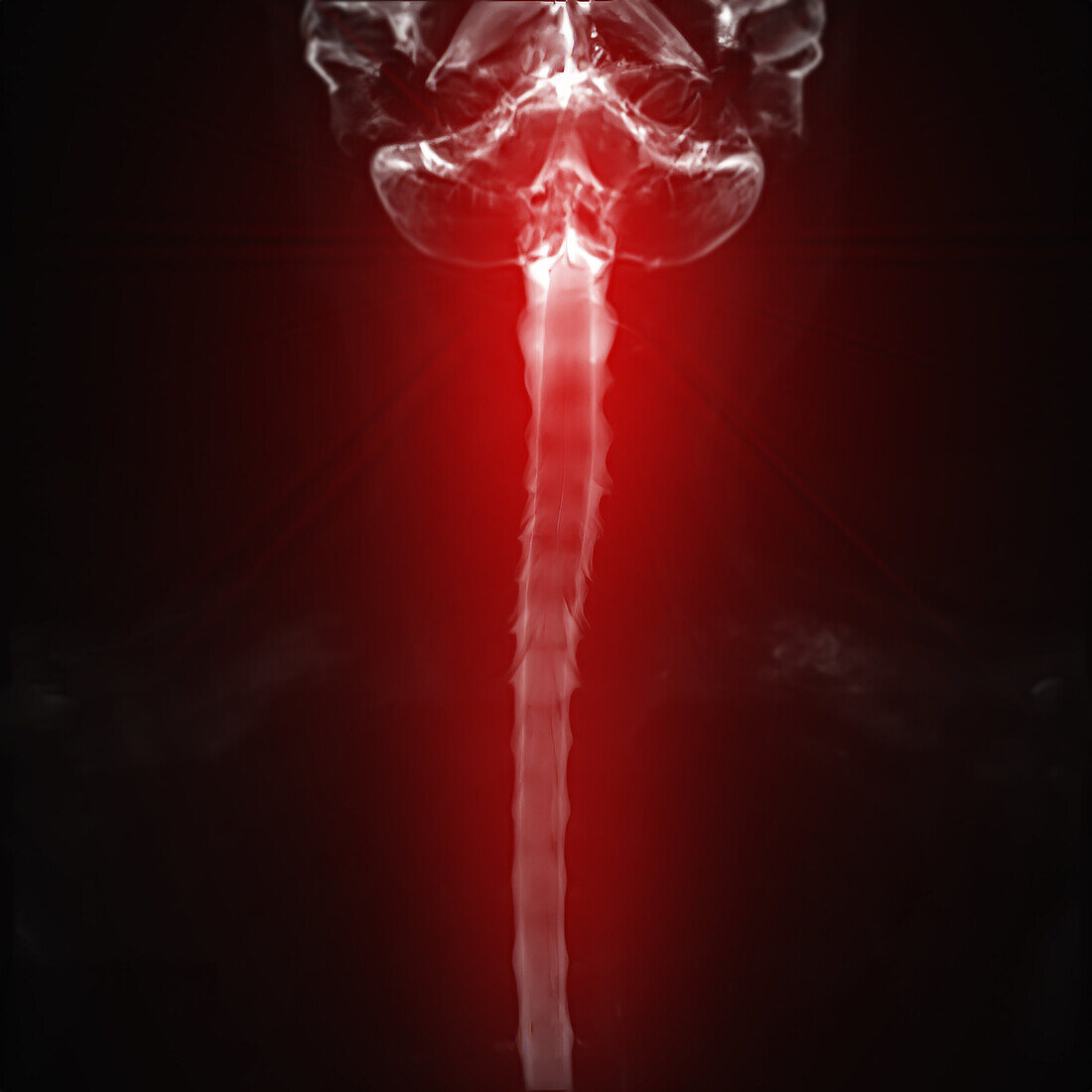 Healthy cervical spine, myelogram