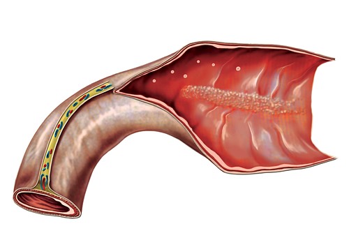 Ileum Bilder Science Photo Library