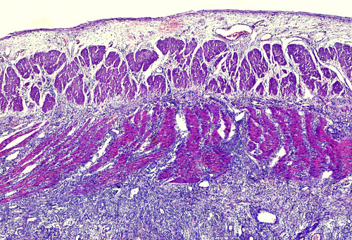 Ileum Bilder Science Photo Library