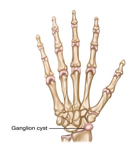 Ganglion Bilder Science Photo Library