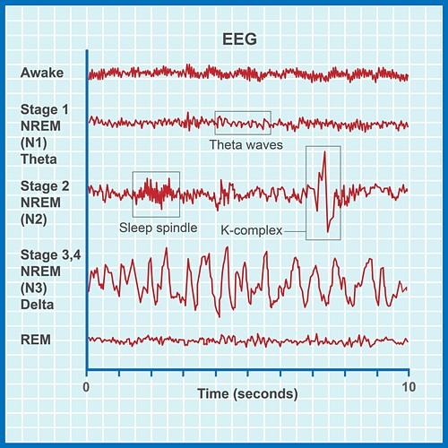 Électroencéphalogramme Photos Science Photo Library