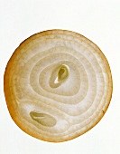 Cross Section of an Onion