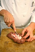 Man's hands removing fat from the kidney with knife