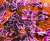 Crystals of albumin on a wound
