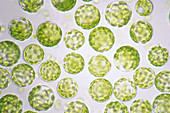 Protoplasts in tobacco leaf cells