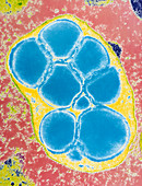 False-colour TEM of an amyloplast