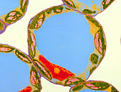 Chloroplasts in cells of Zinnia