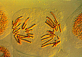 Anaphase of mitosis in bluebell cells