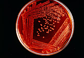 Culture of Salmonella typhi bacteria