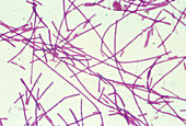 LM of bacteria Bacillus anthracis