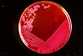Colonies of E. coli and Proteus vulgaris